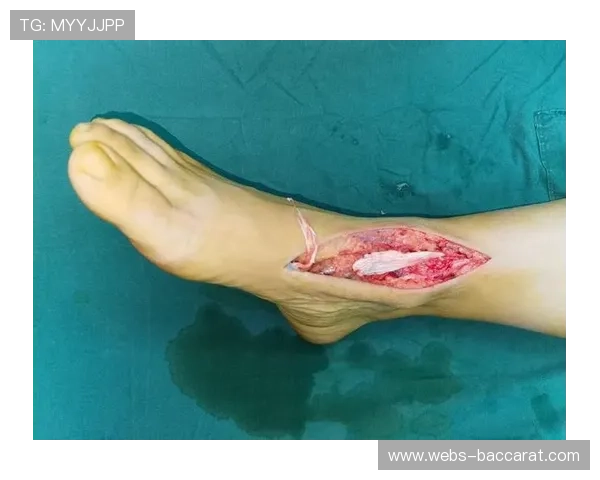 邓弗里斯脚踝伤势不明，场外问题亦造成困扰